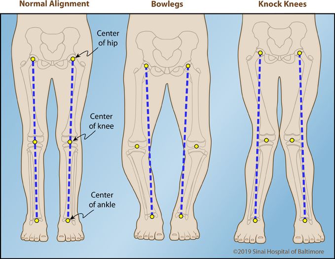 knee joint alignments 